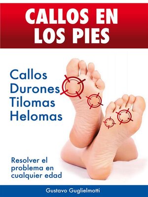 cover image of CALLOS EN LOS PIES--Solución definitiva para Callos, Tilomas y Helomas.
